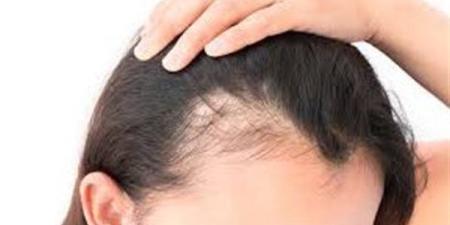 أفضل زيت لإنبات الشعر وتكثيفه من أسرار الطبيعة
