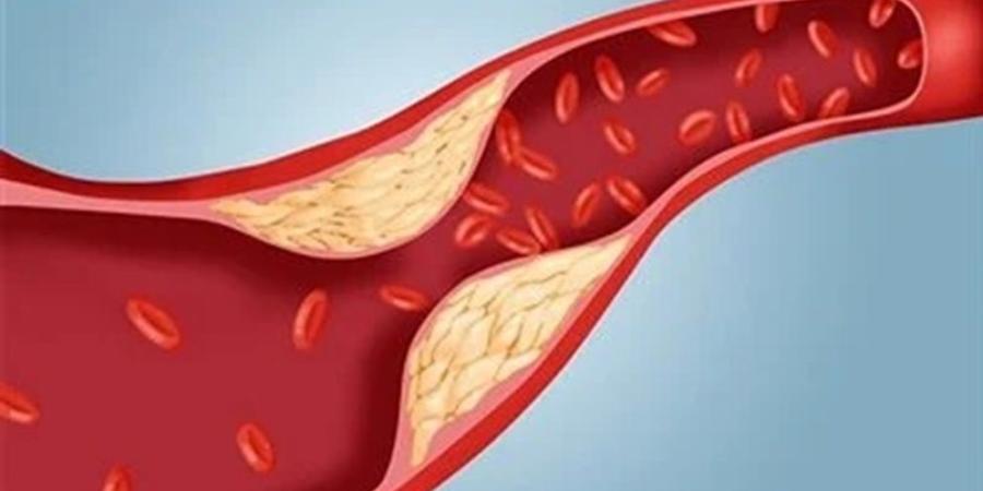 للتخلص من الكولسترول.. إليكم 7 طرق بسيطة